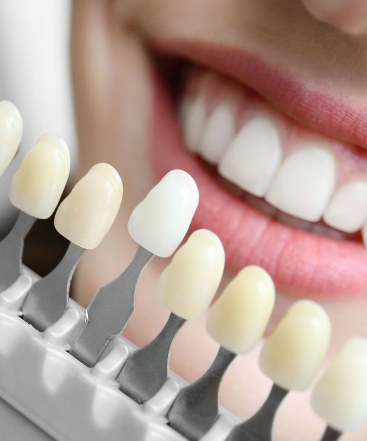 Farbwahl von einer Teilkrone